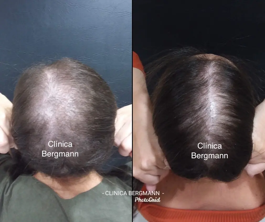 Dermatologista Especialista em Queda de Cabelo