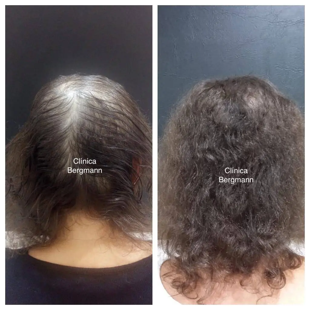 Dermatologista Especialista em Queda de Cabelo