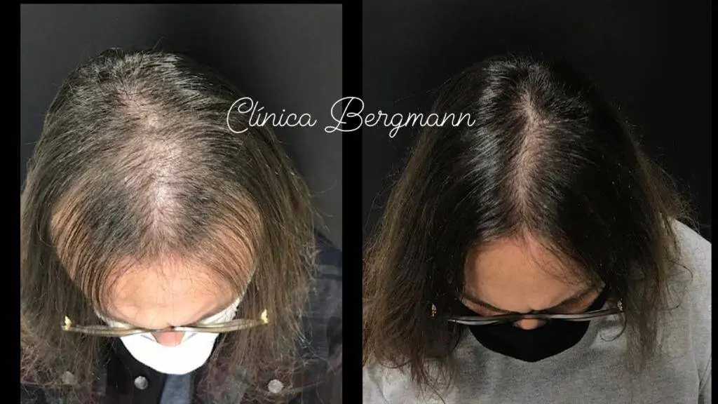 Dermatologista Especialista em Queda de Cabelo