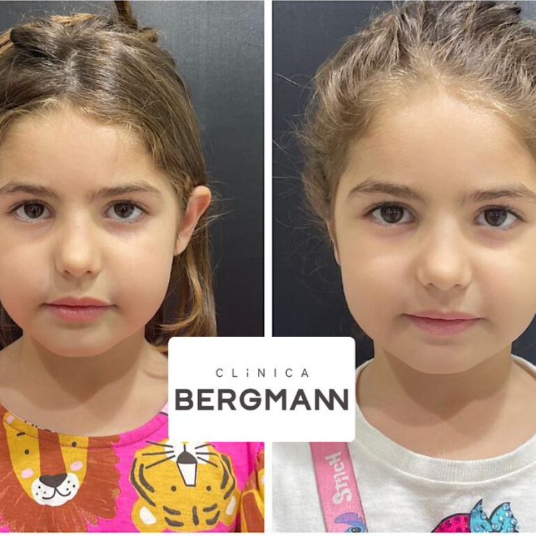 Orelha de Abano Porto Alegre RS Moinhos de Vento